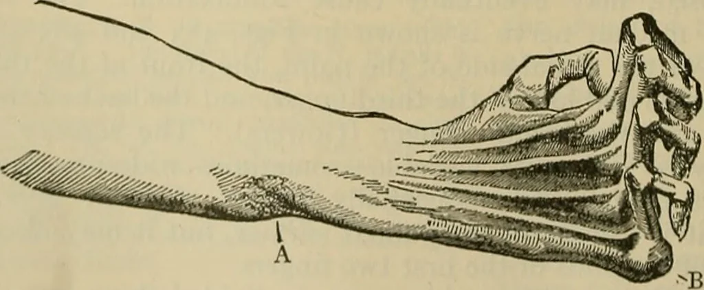 An illustration from Modern surgery, general and operative / by John Chalmers DaCosta., 1914, leaf 776