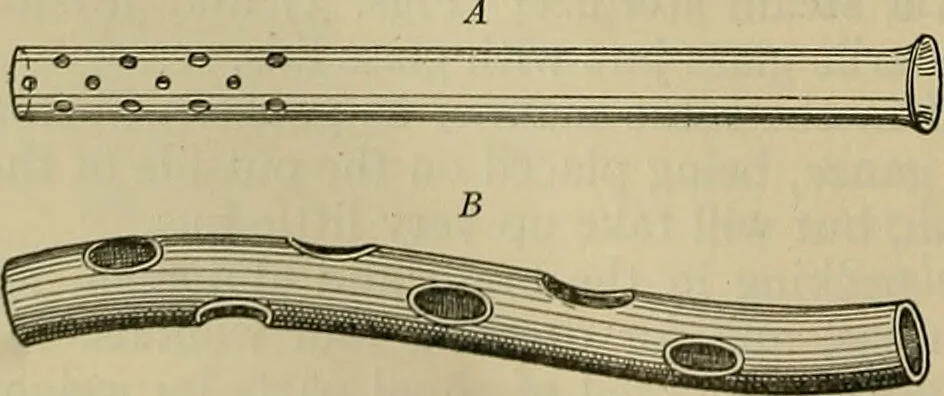 An illustration from Modern surgery, general and operative / by John Chalmers DaCosta., 1914, leaf 78