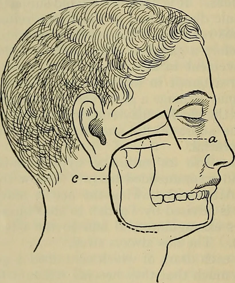 An illustration from Modern surgery, general and operative / by John Chalmers DaCosta., 1914, leaf 786
