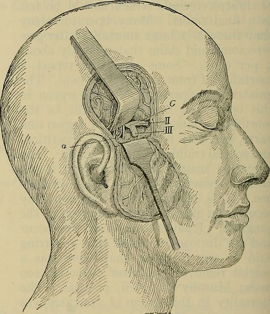 An illustration from Modern surgery, general and operative / by John Chalmers DaCosta., 1914, leaf 788