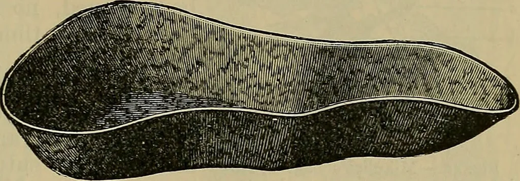 An illustration from Modern surgery, general and operative / by John Chalmers DaCosta., 1914, leaf 79