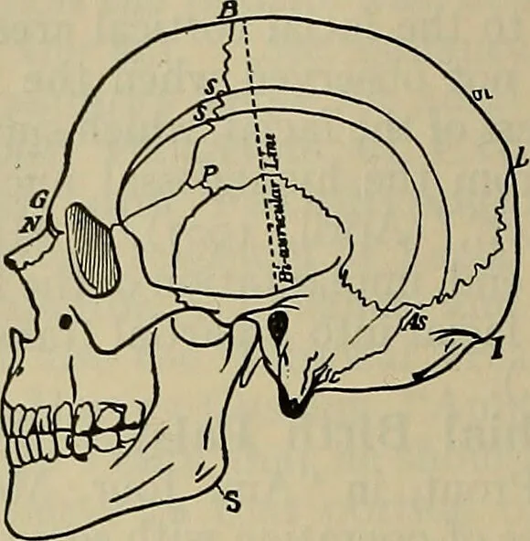 An illustration from Modern surgery, general and operative / by John Chalmers DaCosta., 1914, leaf 792