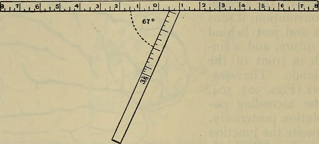 An illustration from Modern surgery, general and operative / by John Chalmers DaCosta., 1914, leaf 794