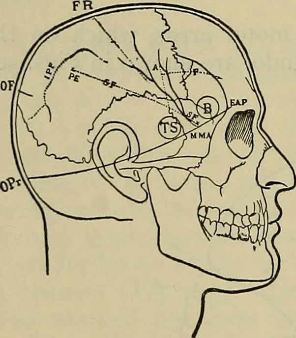 An illustration from Modern surgery, general and operative / by John Chalmers DaCosta., 1914, leaf 794