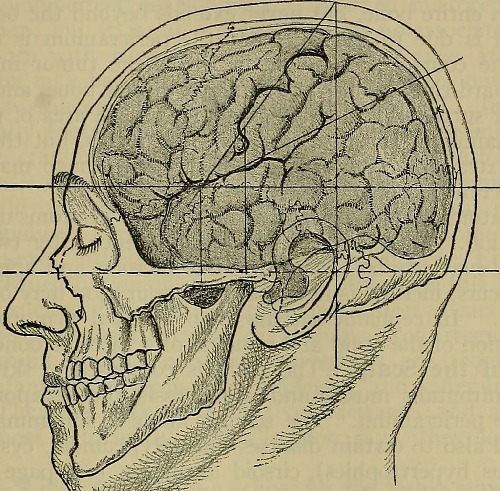 An illustration from Modern surgery, general and operative / by John Chalmers DaCosta., 1914, leaf 795