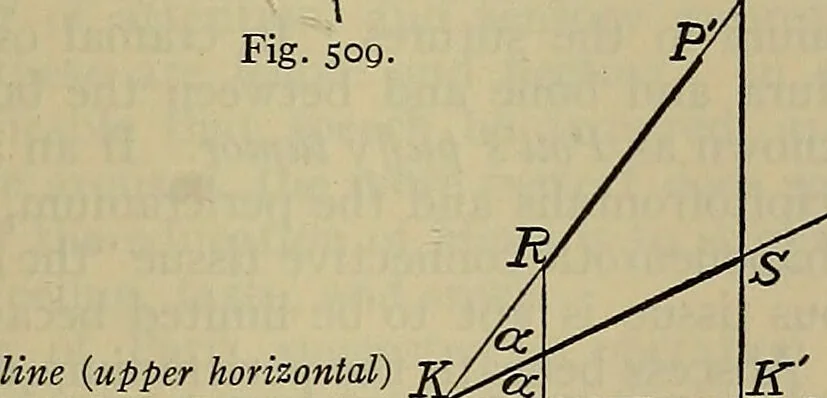 An illustration from Modern surgery, general and operative / by John Chalmers DaCosta., 1914, leaf 795