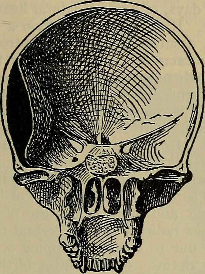 An illustration from Modern surgery, general and operative / by John Chalmers DaCosta., 1914, leaf 809