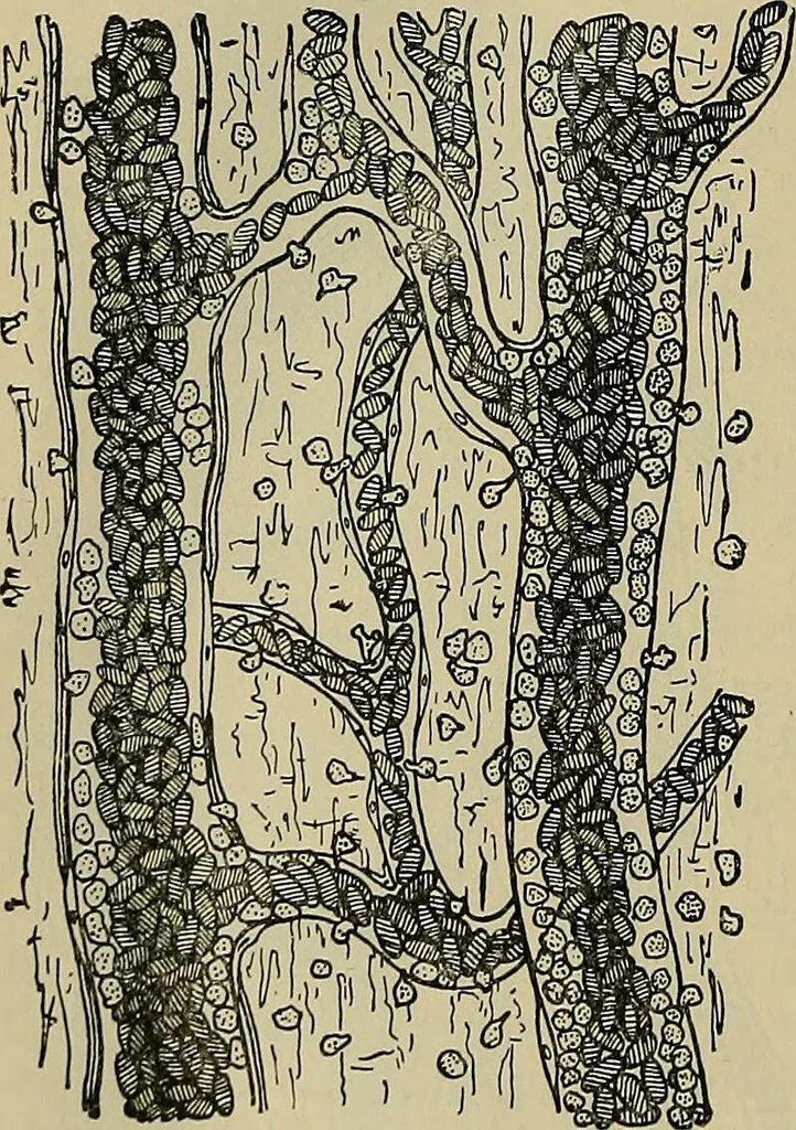 An illustration from Modern surgery, general and operative / by John Chalmers DaCosta., 1914, leaf 82