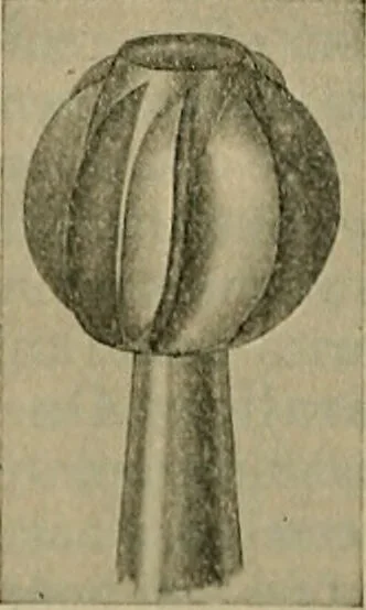 An illustration from Modern surgery, general and operative / by John Chalmers DaCosta., 1914, leaf 848