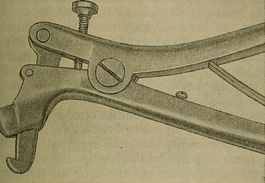 An illustration from Modern surgery, general and operative / by John Chalmers DaCosta., 1914, leaf 849