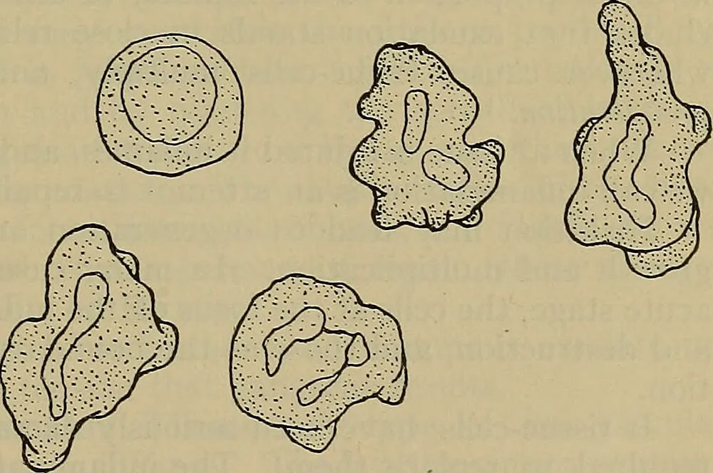 An illustration from Modern surgery, general and operative / by John Chalmers DaCosta., 1914, leaf 85