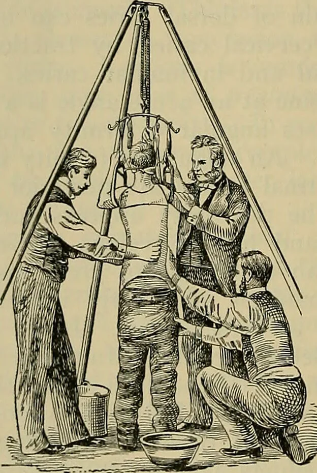 An illustration from Modern surgery, general and operative / by John Chalmers DaCosta., 1914, leaf 870