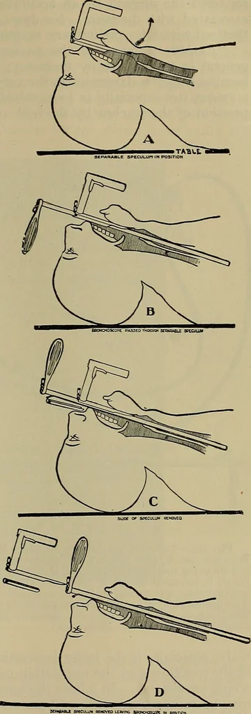 An illustration from Modern surgery, general and operative / by John Chalmers DaCosta., 1914, leaf 911
