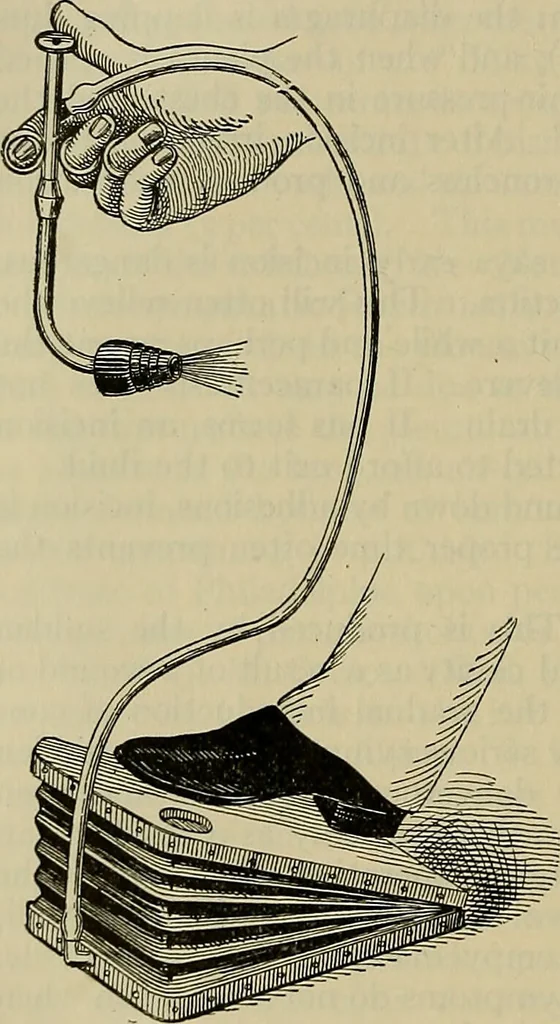 An illustration from Modern surgery, general and operative / by John Chalmers DaCosta., 1914, leaf 920