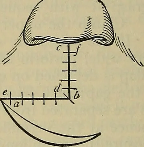 An illustration from Modern surgery, general and operative / by John Chalmers DaCosta., 1914, leaf 942