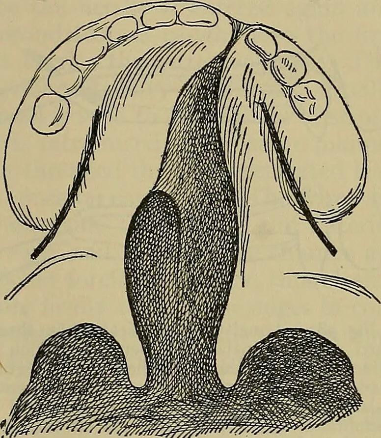 An illustration from Modern surgery, general and operative / by John Chalmers DaCosta., 1914, leaf 945