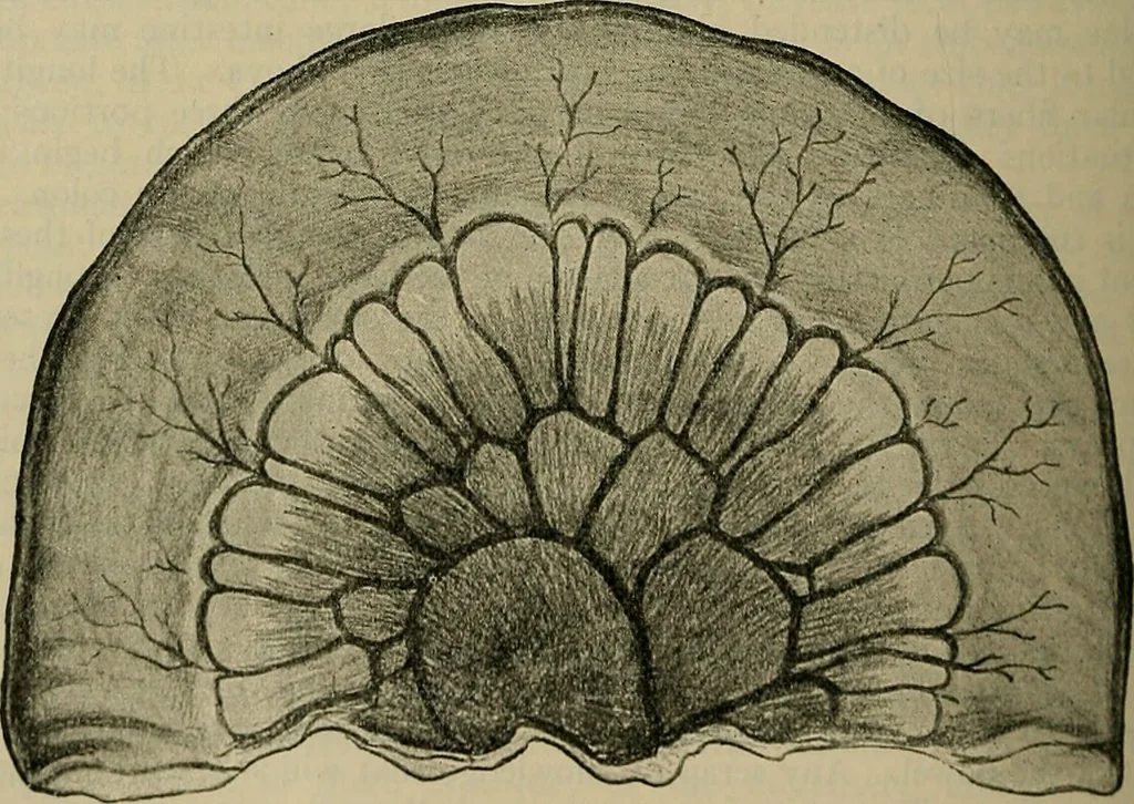 An illustration from Modern surgery, general and operative / by John Chalmers DaCosta., 1914, leaf 974