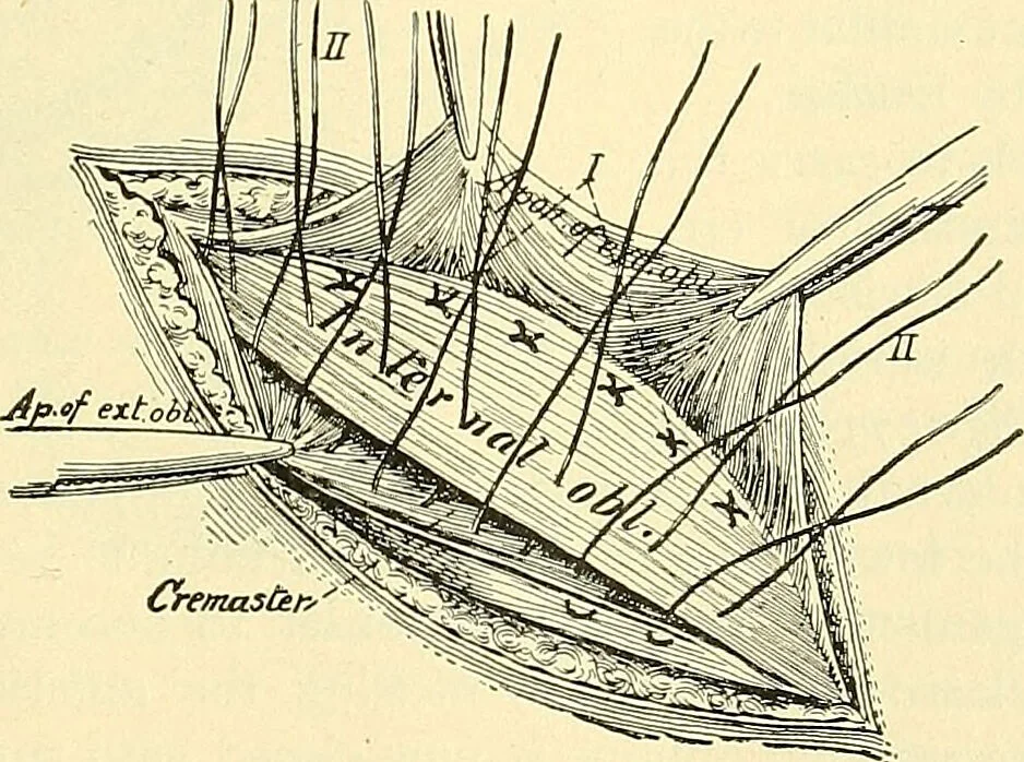 An illustration from Modern surgery, general and operative / by John Chalmers Da Costa., 1907, leaf 1009