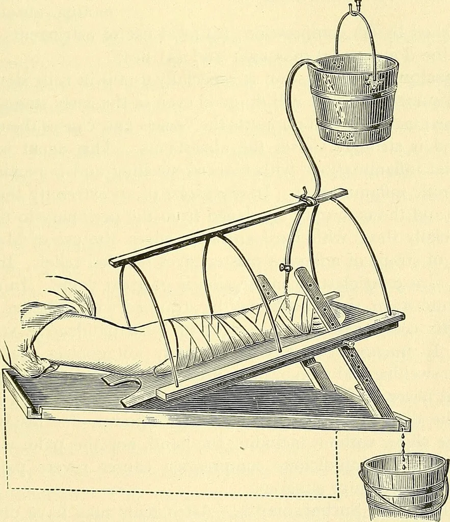 An illustration from Modern surgery, general and operative / by John Chalmers Da Costa., 1907, leaf 101