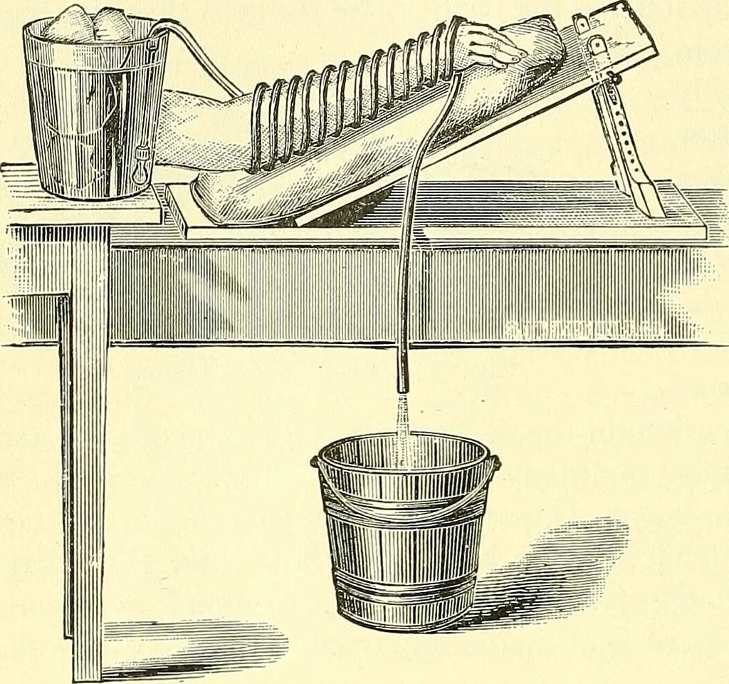 An illustration from Modern surgery, general and operative / by John Chalmers Da Costa., 1907, leaf 102