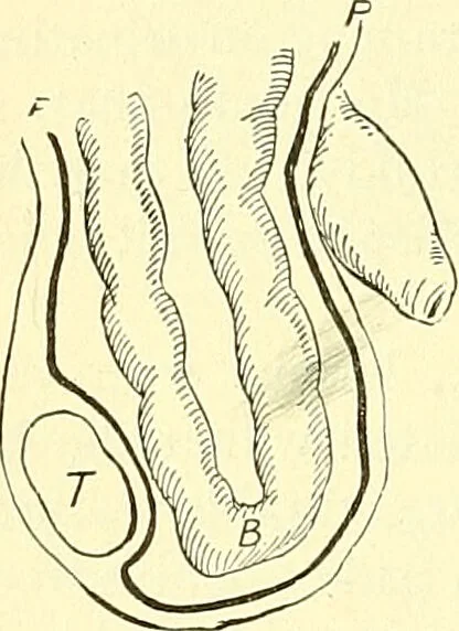An illustration from Modern surgery, general and operative / by John Chalmers Da Costa., 1907, leaf 1026