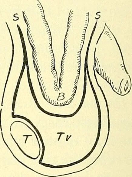 An illustration from Modern surgery, general and operative / by John Chalmers Da Costa., 1907, leaf 1026