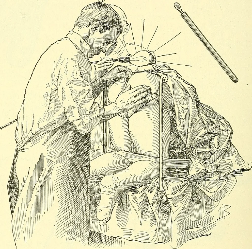 An illustration from Modern surgery, general and operative / by John Chalmers Da Costa., 1907, leaf 1032