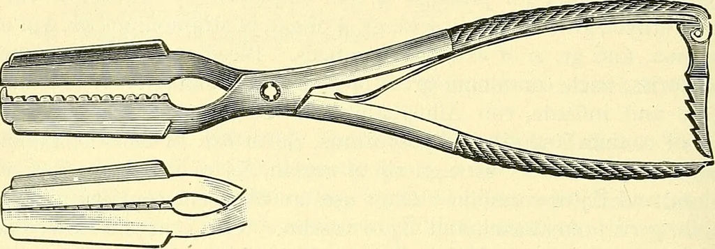An illustration from Modern surgery, general and operative / by John Chalmers Da Costa., 1907, leaf 1042