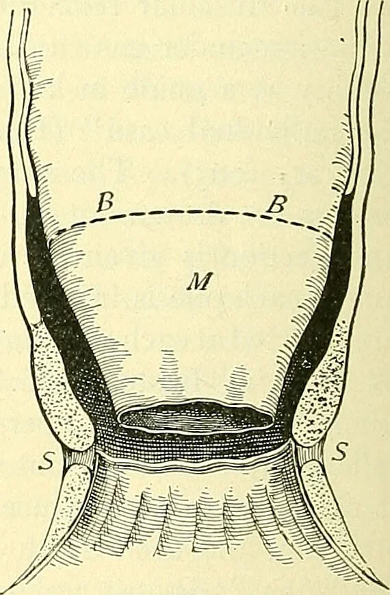 An illustration from Modern surgery, general and operative / by John Chalmers Da Costa., 1907, leaf 1042