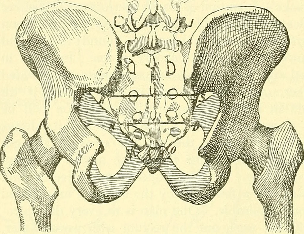 An illustration from Modern surgery, general and operative / by John Chalmers Da Costa., 1907, leaf 1050