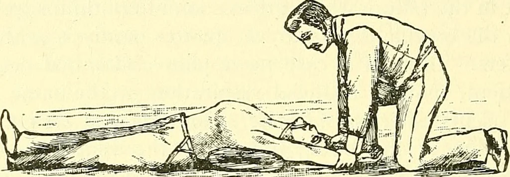 An illustration from Modern surgery, general and operative / by John Chalmers Da Costa., 1907, leaf 1062