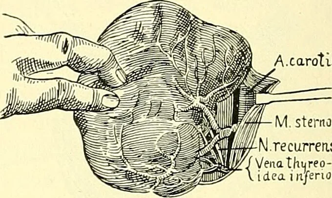 An illustration from Modern surgery, general and operative / by John Chalmers Da Costa., 1907, leaf 1098