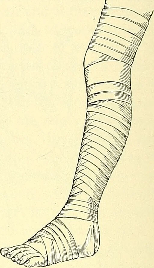 An illustration from Modern surgery, general and operative / by John Chalmers Da Costa., 1907, leaf 1108