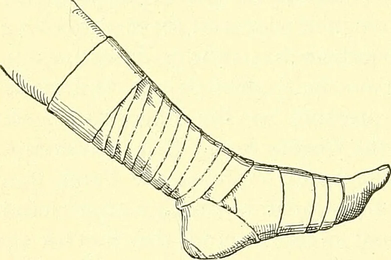 An illustration from Modern surgery, general and operative / by John Chalmers Da Costa., 1907, leaf 1108