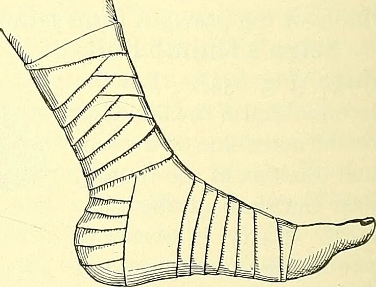 An illustration from Modern surgery, general and operative / by John Chalmers Da Costa., 1907, leaf 1108