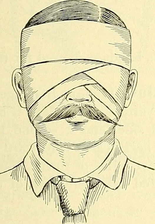 An illustration from Modern surgery, general and operative / by John Chalmers Da Costa., 1907, leaf 1109