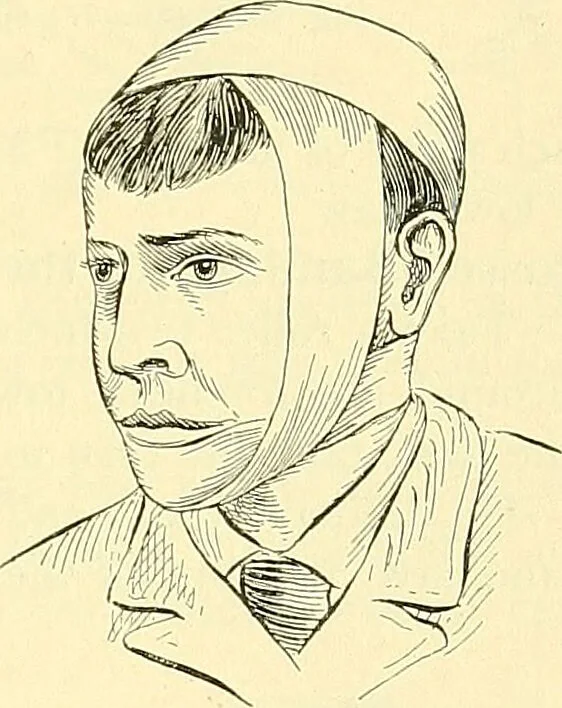 An illustration from Modern surgery, general and operative / by John Chalmers Da Costa., 1907, leaf 1109