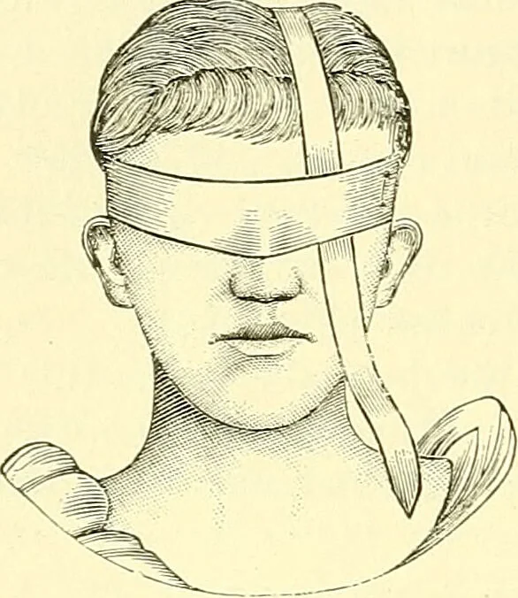 An illustration from Modern surgery, general and operative / by John Chalmers Da Costa., 1907, leaf 1110