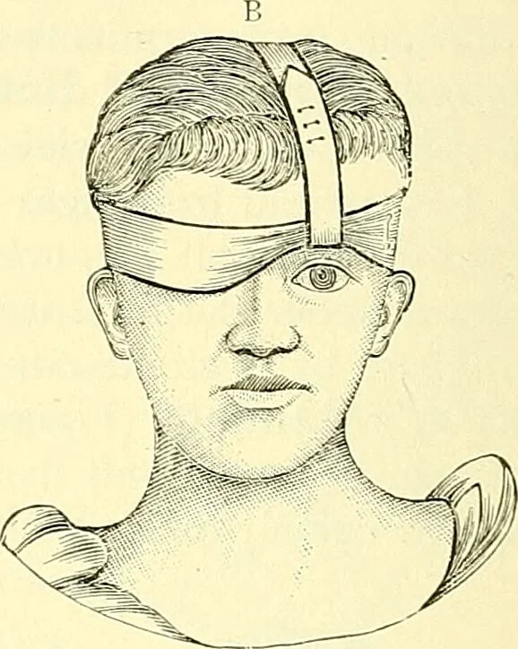 An illustration from Modern surgery, general and operative / by John Chalmers Da Costa., 1907, leaf 1110