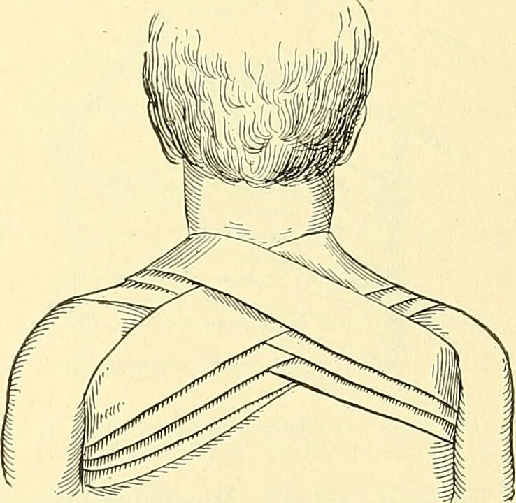 An illustration from Modern surgery, general and operative / by John Chalmers Da Costa., 1907, leaf 1111