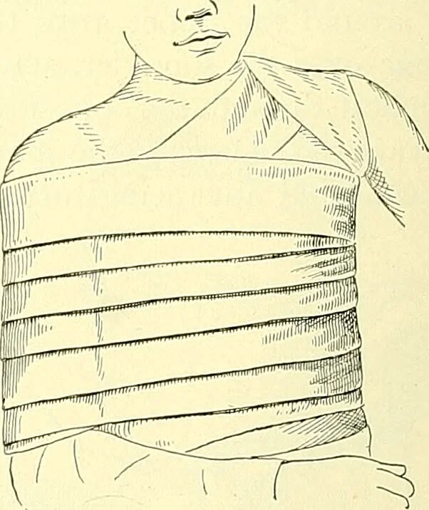 An illustration from Modern surgery, general and operative / by John Chalmers Da Costa., 1907, leaf 1112