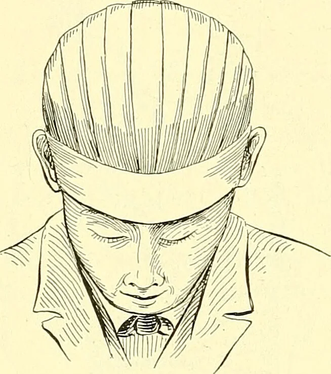 An illustration from Modern surgery, general and operative / by John Chalmers Da Costa., 1907, leaf 1114