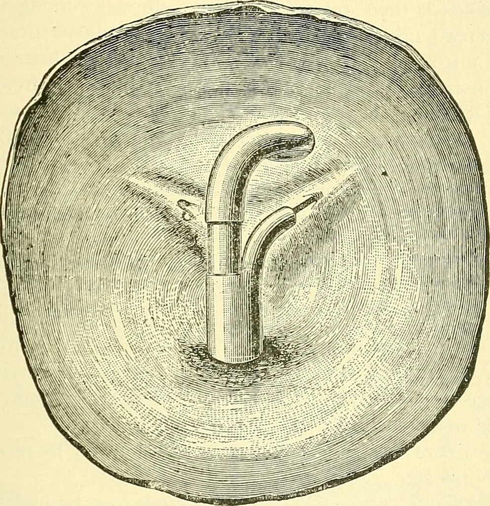 An illustration from Modern surgery, general and operative / by John Chalmers Da Costa., 1907, leaf 1121