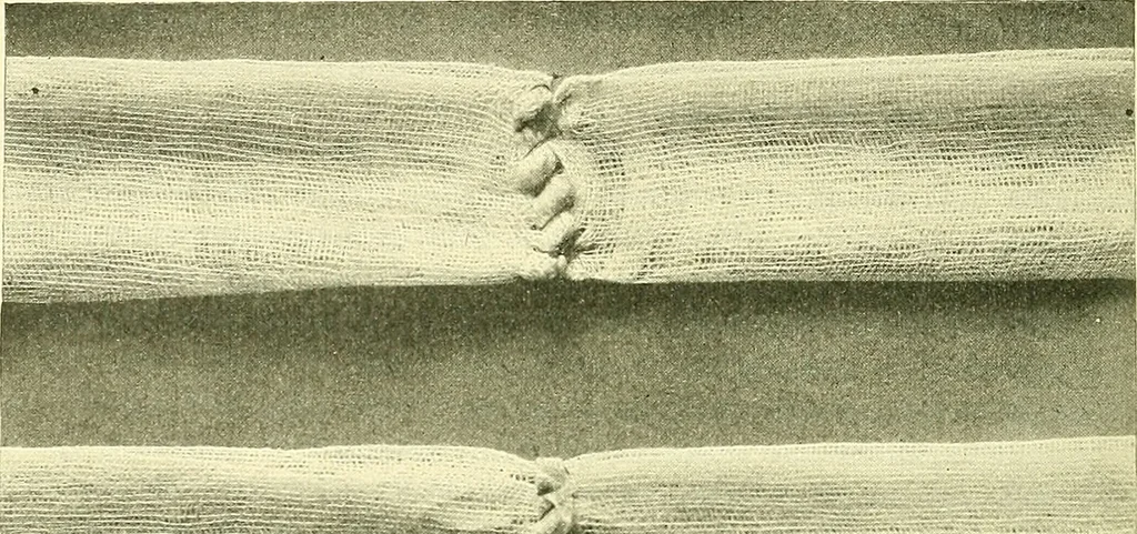 An illustration from Modern surgery, general and operative / by John Chalmers Da Costa., 1907, leaf 1146