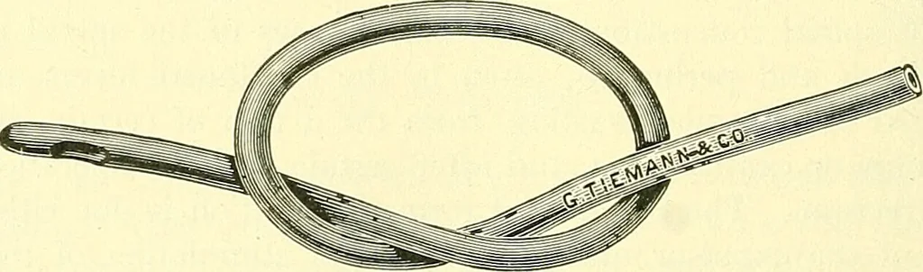 An illustration from Modern surgery, general and operative / by John Chalmers Da Costa., 1907, leaf 1152