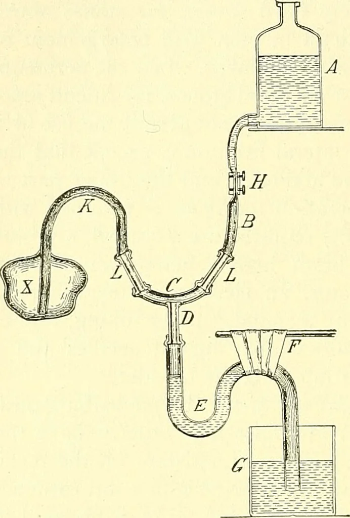 An illustration from Modern surgery, general and operative / by John Chalmers Da Costa., 1907, leaf 1168