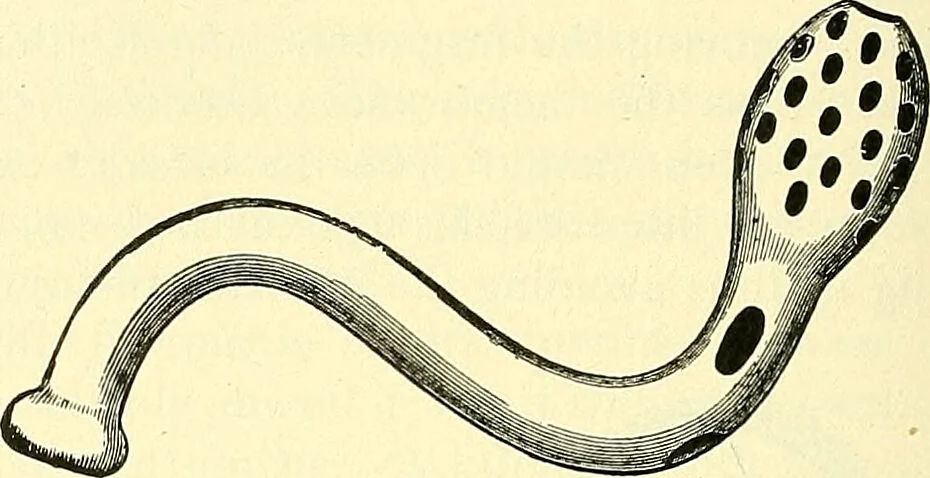 An illustration from Modern surgery, general and operative / by John Chalmers Da Costa., 1907, leaf 1174