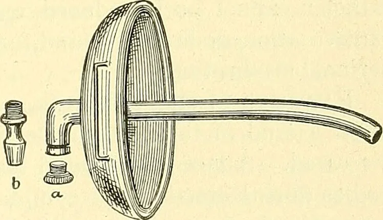 An illustration from Modern surgery, general and operative / by John Chalmers Da Costa., 1907, leaf 1175