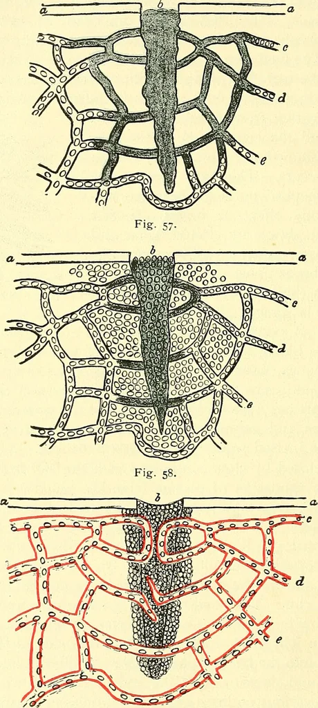 An illustration from Modern surgery, general and operative / by John Chalmers Da Costa., 1907, leaf 118