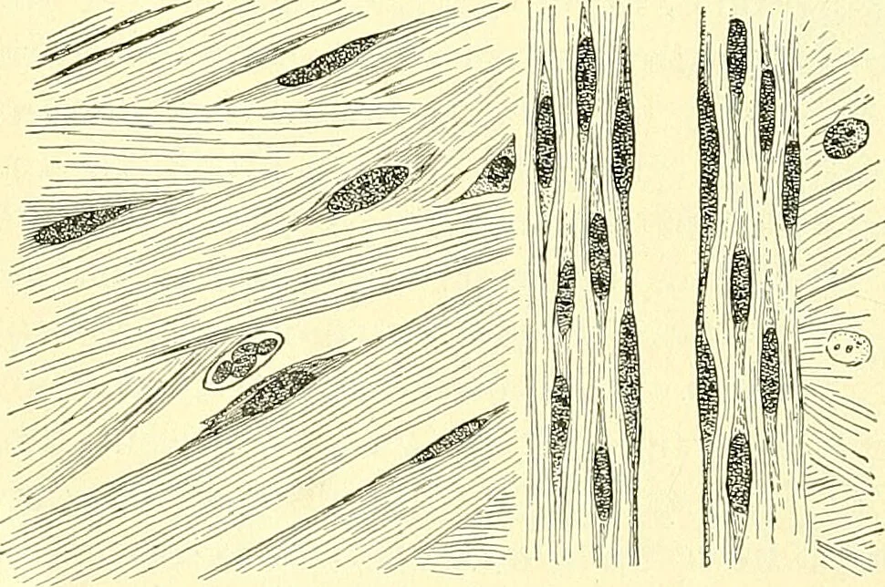 An illustration from Modern surgery, general and operative / by John Chalmers Da Costa., 1907, leaf 120